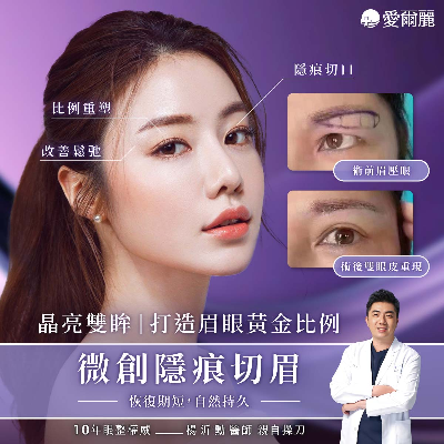 微創隱痕切眉  晶亮雙眸，打造眉眼黃金比例